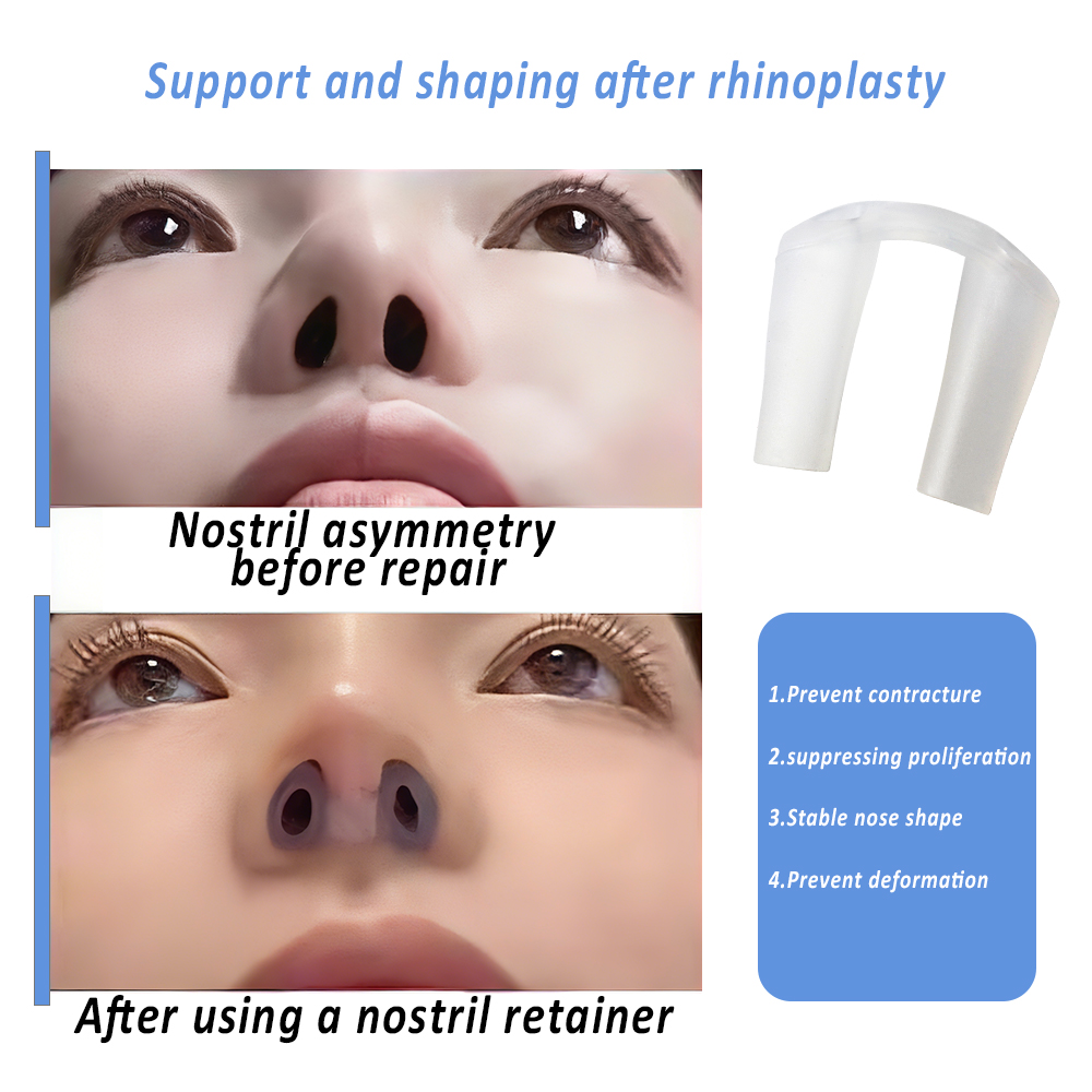 Nostril Retainer for Rhinoplas - Anti Snore Contour Pillow review and price